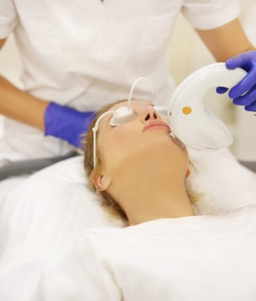 Woman-IPL-treatment-M22-720x601