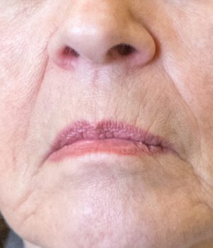 Woman with downturned mouth corner concerns