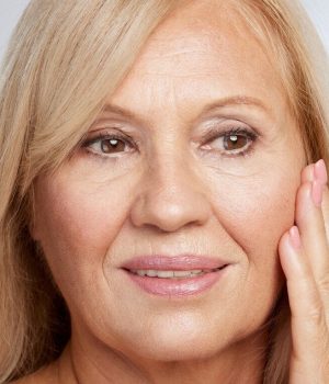 Woman with jowls concerns