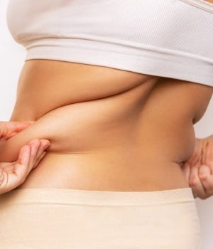 Woman with stubborn pockets of fat concerns