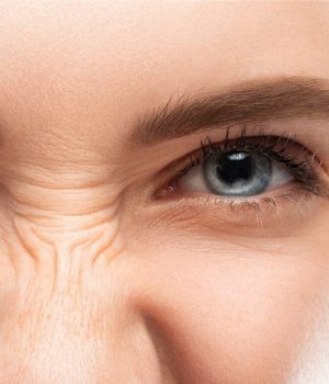 Woman with bunny scrunch lines concerns