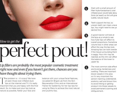 Metropol: How to get the perfect pout!