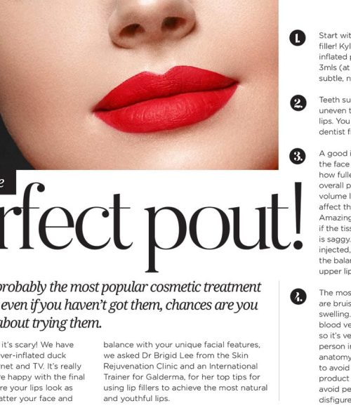 Metropol: How to get the perfect pout!