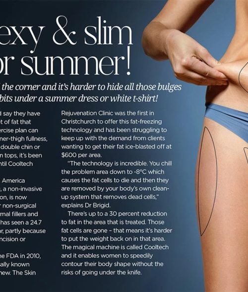 Metropol: Sexy & slim for summer!